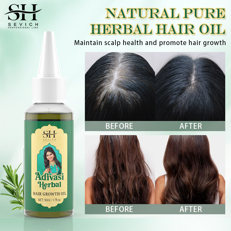 Ayurvedic saç büyüme yağı Adiv - Ayurvedic & Herbal Wellness Kits incelemesi ve fiyatı